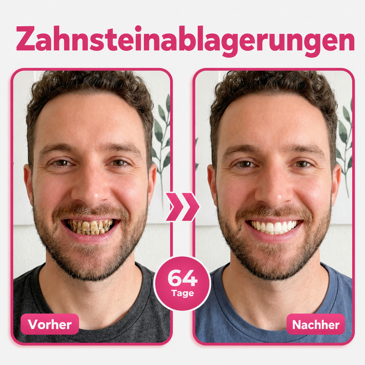 Natravor® Thismile NH-10 Zahnpasta-Serum für Zahnschmelz und Zahnfleisch – Advanced Therapy