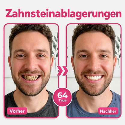 Natravor® Thismile NH-10 Zahnpasta-Serum für Zahnschmelz und Zahnfleisch – Advanced Therapy