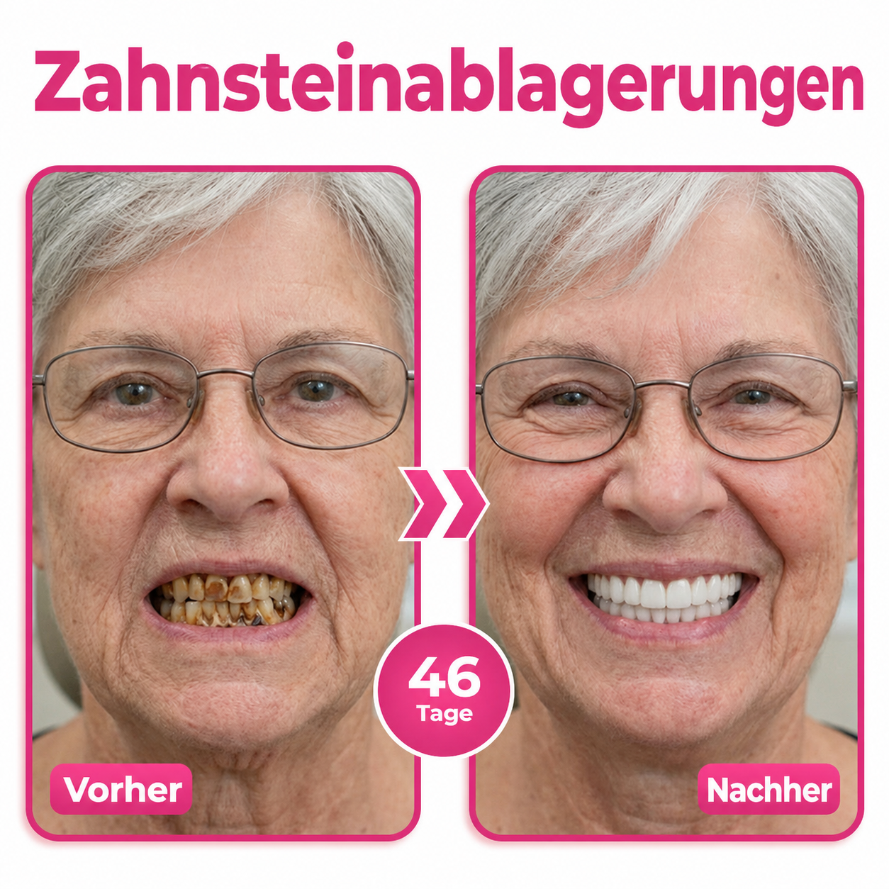 Natravor® Thismile NH-10 Zahnpasta-Serum für Zahnschmelz und Zahnfleisch – Advanced Therapy
