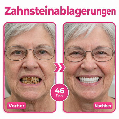 Natravor® Thismile NH-10 Zahnpasta-Serum für Zahnschmelz und Zahnfleisch – Advanced Therapy